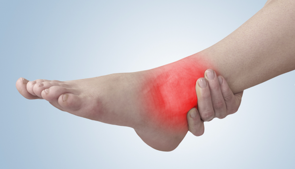 Sprained ankles: Causes, symptoms, and effective treatment methods