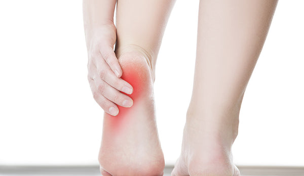 Sperone calcaneare: origine, trattamento conservativo e terapia con onde d'urto